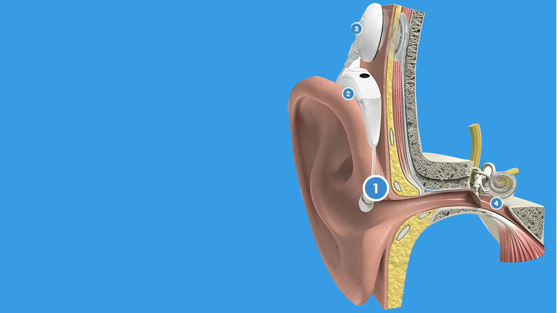Laparoscopic and Bariatric Surgery Keyhole Surgery