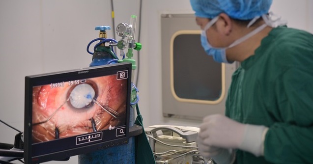 glaucoma